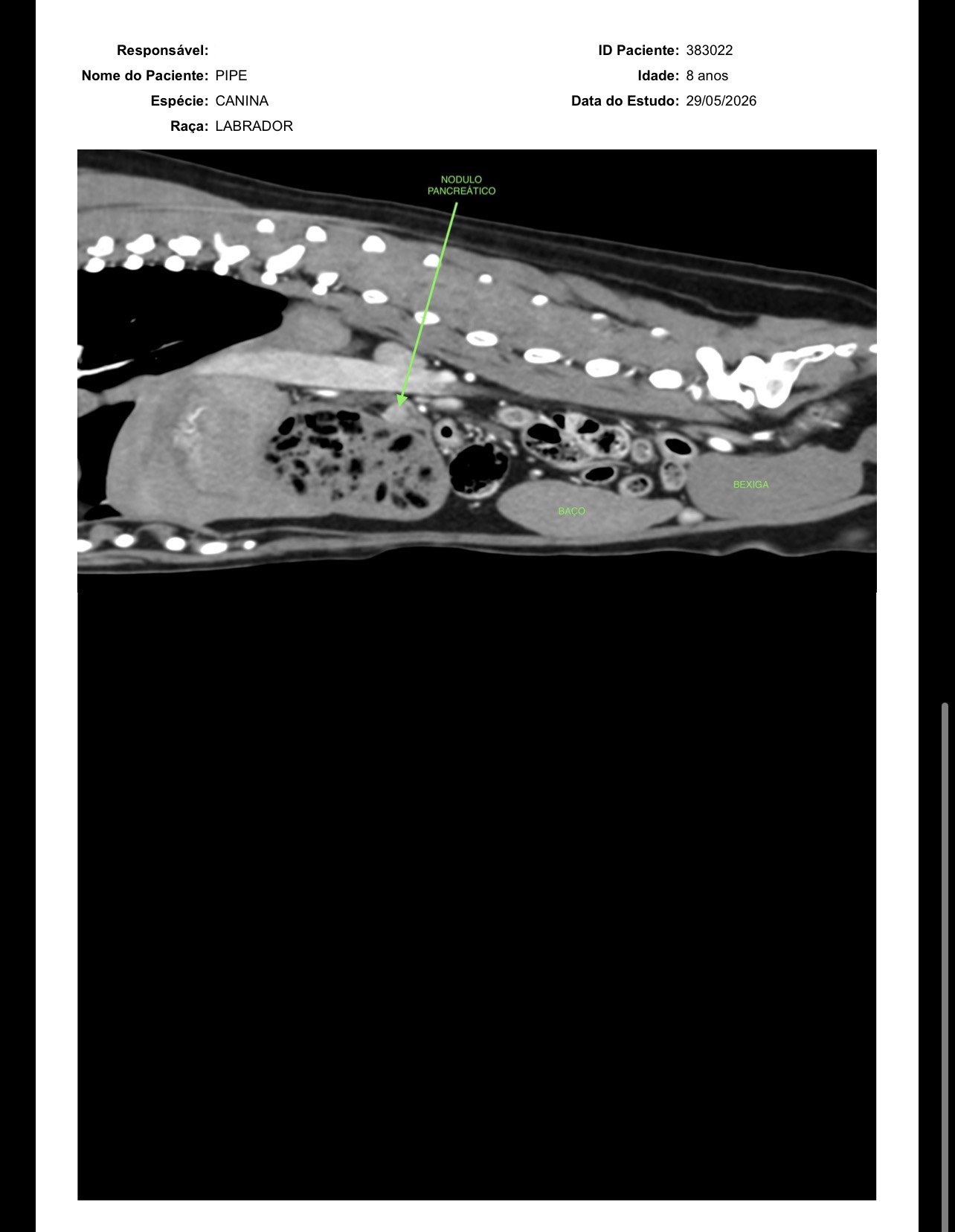 Imagem da tomografia — vista sagital